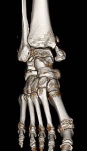 Understanding injury