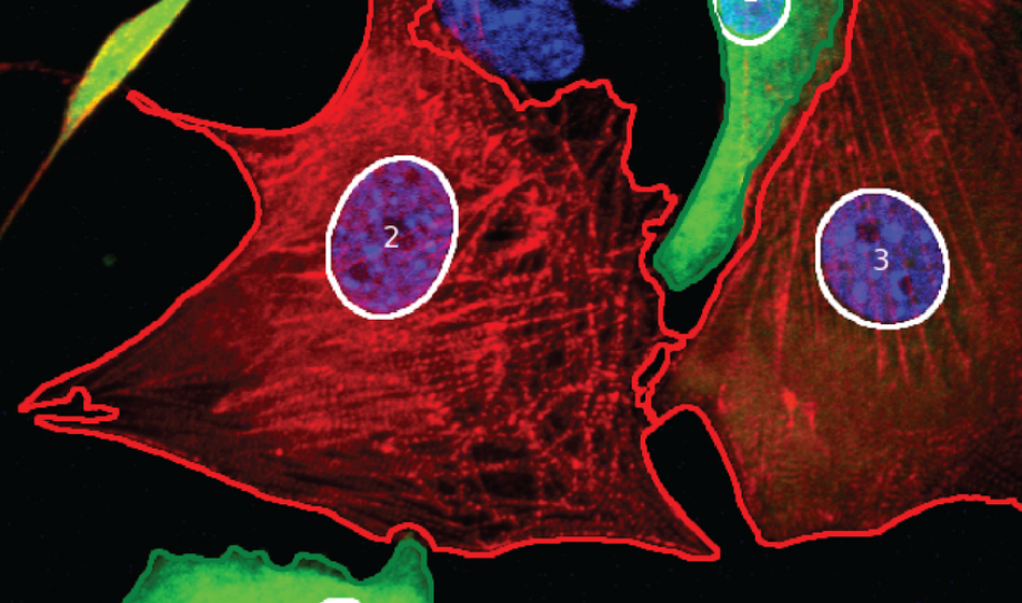 Automated image analysis of cardiac cells and tissue.