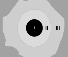Focused Ultrasound Surgery: Image Analyses