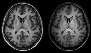 brain scans.