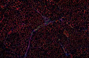 A histology image of a skeletal muscle cross-section