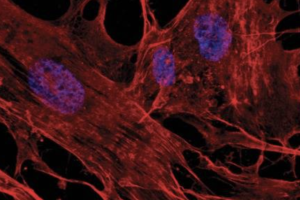 Phalloidin actin stain (red) and Hoescht 33342 