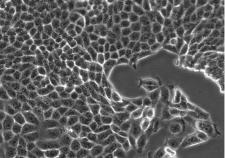 collective migration of Madin-Darby canine kidney (MDCK) epithelial cells on a substrate made by soft, 'dry' polydimethylsiloxane (PDMS) elastomers.
