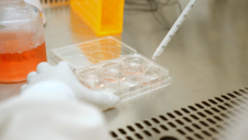 Closeup of pipetting solution into a lab dish